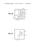 DEVICES AND METHODS FOR DELIVERING ACTIVE AGENTS TO THE OSTEOMEATAL     COMPLEX diagram and image