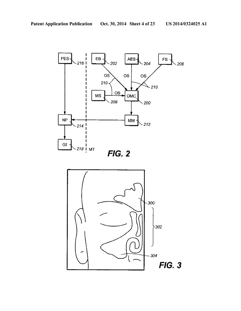 DEVICES AND METHODS FOR DELIVERING ACTIVE AGENTS TO THE OSTEOMEATAL     COMPLEX - diagram, schematic, and image 05