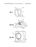 DEVICES AND METHODS FOR DELIVERING ACTIVE AGENTS TO THE OSTEOMEATAL     COMPLEX diagram and image