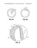 DEVICES AND METHODS FOR DELIVERING ACTIVE AGENTS TO THE OSTEOMEATAL     COMPLEX diagram and image