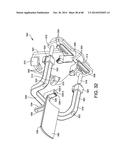 ORTHOPEDIC SURGICAL GUIDE diagram and image