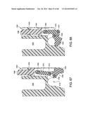 ORTHOPEDIC SURGICAL GUIDE diagram and image