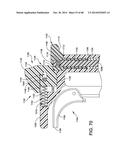 ORTHOPEDIC SURGICAL GUIDE diagram and image