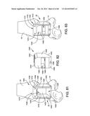 ORTHOPEDIC SURGICAL GUIDE diagram and image