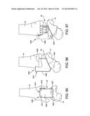 ORTHOPEDIC SURGICAL GUIDE diagram and image