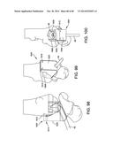 ORTHOPEDIC SURGICAL GUIDE diagram and image