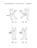 APPARATUS AND METHOD FOR DISTRACTING THE HIP JOINT diagram and image