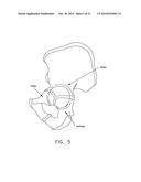 APPARATUS AND METHOD FOR DISTRACTING THE HIP JOINT diagram and image