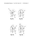 ACQUIRING CONTACT POSITION PARAMETERS AND DETECTING CONTACT OF A JOINT diagram and image