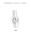 ACQUIRING CONTACT POSITION PARAMETERS AND DETECTING CONTACT OF A JOINT diagram and image