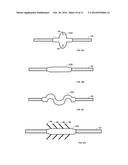 INTRODUCTION AND ANCHORING TOOL FOR AN IMPLANTABLE MEDICAL DEVICE ELEMENT diagram and image