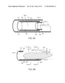 TISSUE RESECTING SYSTEMS AND METHODS diagram and image