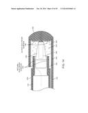 TISSUE RESECTING SYSTEMS AND METHODS diagram and image