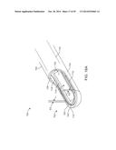 TISSUE RESECTING SYSTEMS AND METHODS diagram and image