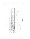 TISSUE RESECTING SYSTEMS AND METHODS diagram and image