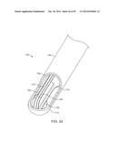 TISSUE RESECTING SYSTEMS AND METHODS diagram and image