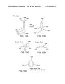 SUBCUTANEOUS TUNNELING AND IMPLANTATION TOOLS FOR A DISK-SHAPED SENSOR diagram and image