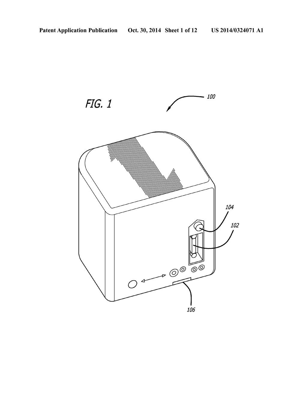 REAL-TIME SURGICAL REFERENCE INDICIUM APPARATUS AND METHODS FOR     ASTIGMATISM CORRECTION - diagram, schematic, and image 02