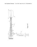 INFLATABLE MEDICAL DEVICES diagram and image