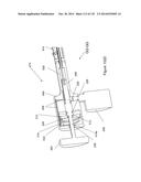 INFLATABLE MEDICAL DEVICES diagram and image