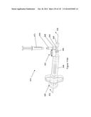 INFLATABLE MEDICAL DEVICES diagram and image