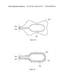 INFLATABLE MEDICAL DEVICES diagram and image