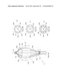 INFLATABLE MEDICAL DEVICES diagram and image