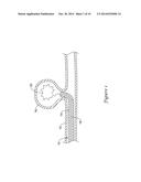 INTRODUCER SHEATH FOR USE WITH AN EMBOLIC COIL DEVICE AND METHODS FOR     MAKING AND USING THE SAME diagram and image