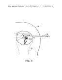 Suture Anchor Device, Kit and Method diagram and image