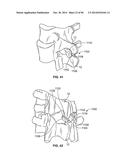 INTERVERTEBRAL IMPLANT DEVICES AND METHODS FOR INSERTION THEREOF diagram and image