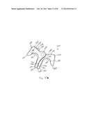 INTERVERTEBRAL IMPLANT DEVICES AND METHODS FOR INSERTION THEREOF diagram and image