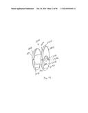 INTERVERTEBRAL IMPLANT DEVICES AND METHODS FOR INSERTION THEREOF diagram and image