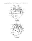 CRANIAL BURR HOLE PLUG WITH ANTI-SKEWING CLAMPING MECHANISM diagram and image