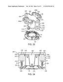 CRANIAL BURR HOLE PLUG WITH ANTI-SKEWING CLAMPING MECHANISM diagram and image