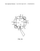 CRANIAL BURR HOLE PLUG WITH ANTI-SKEWING CLAMPING MECHANISM diagram and image