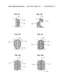 SYSTEMS FOR PERFORMING INTRALUMENAL RECONSTRUCTION diagram and image