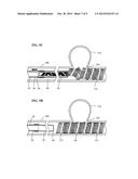 SYSTEMS FOR PERFORMING INTRALUMENAL RECONSTRUCTION diagram and image