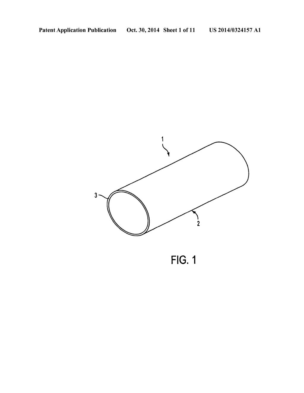 METHODS AND APPARATUS FOR STENTING COMPRISING ENHANCED EMBOLIC PROTECTION     COUPLED WITH IMPROVED PROTECTIONS AGAINST RESTENOSIS AND THROMBUS     FORMATION - diagram, schematic, and image 02