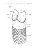 LOW-PROFILE HEART VALVE AND DELIVERY SYSTEM diagram and image