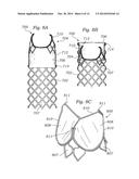 LOW-PROFILE HEART VALVE AND DELIVERY SYSTEM diagram and image