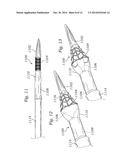 LOW-PROFILE HEART VALVE AND DELIVERY SYSTEM diagram and image