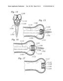 LOW-PROFILE HEART VALVE AND DELIVERY SYSTEM diagram and image