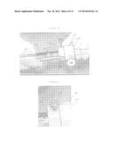 RETRIEVAL AND REPOSITIONING SYSTEM FOR PROSTHETIC HEART VALVE diagram and image