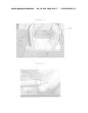 RETRIEVAL AND REPOSITIONING SYSTEM FOR PROSTHETIC HEART VALVE diagram and image