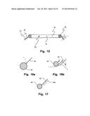 Device And Method For Improving Fixation Of A Medical Device diagram and image