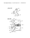 FACET ARTHROPLASTY DEVICES AND METHODS diagram and image