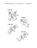 FACET ARTHROPLASTY DEVICES AND METHODS diagram and image