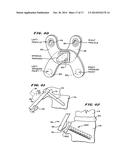 FACET ARTHROPLASTY DEVICES AND METHODS diagram and image