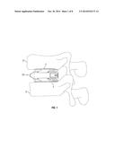 Expandable Fusion Device and Method of Installation Thereof diagram and image