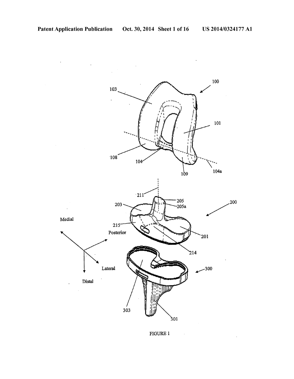 PROSTHETIC JOINT - diagram, schematic, and image 02